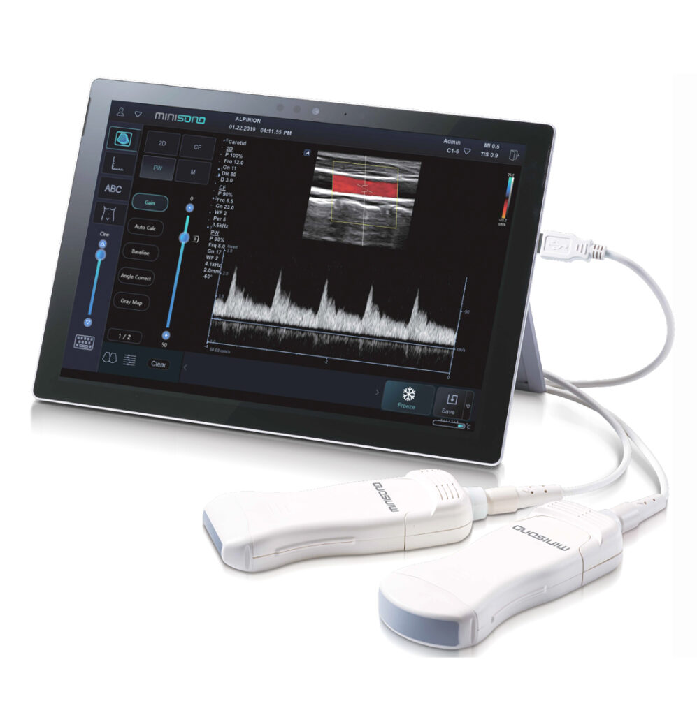 Minisono el ecógrafo ultraportátil - Medical Scan