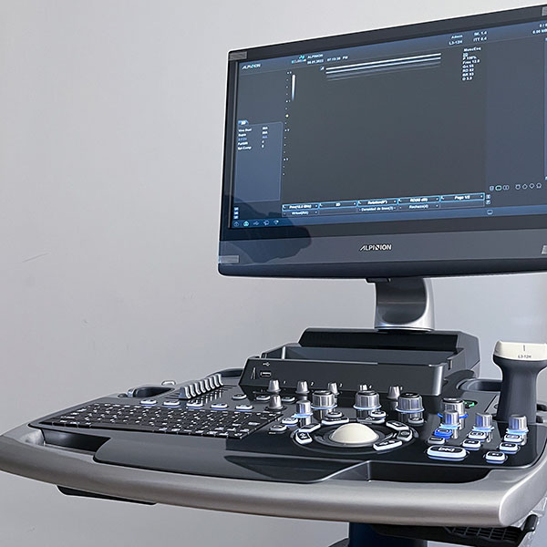 foto parcial de un E-CUBE 8 Le, en donde se ve el monitor y la tabla de mandos con una sonda lineal