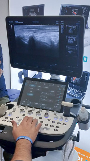 vista parcial del ecógrafo xcube 60 mostrando una ecografía