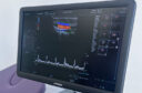 ecografia doppler en x-cube 70