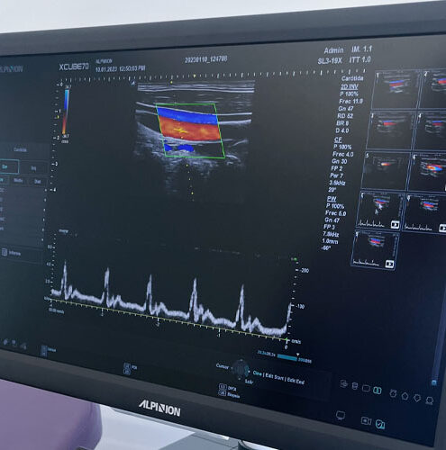 ecografia doppler en x-cube 70