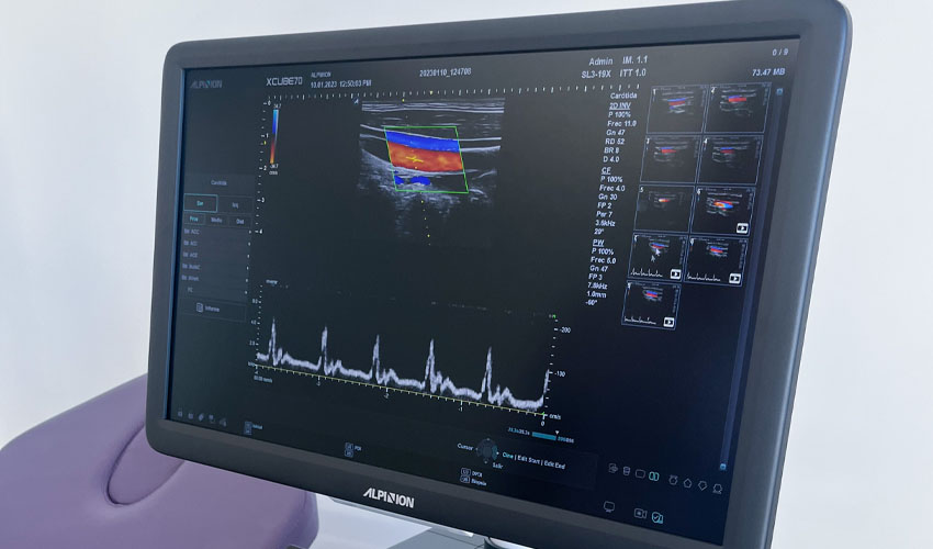 ecografia doppler en x-cube 70