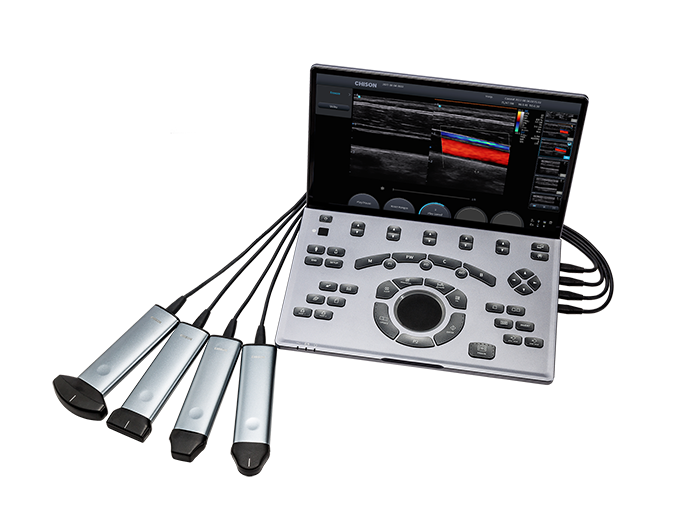 Ecógrafo portátil CHISON SonoAir 60