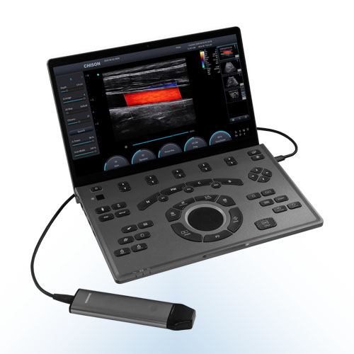 ecógrafo portátil sonoair60 y sonda phase array