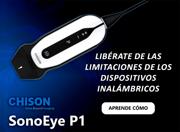 Banner: Ecógrafo portátil CHISON SonoEYE P1 con texto: Libérate de las Limitaciones de los dispositivos inalámbricos CTA: aprende cómo.